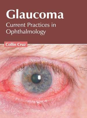 Glaucoma: Current Practices in Ophthalmology de Collin Cruz