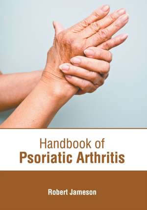 Handbook of Psoriatic Arthritis de Robert Jameson