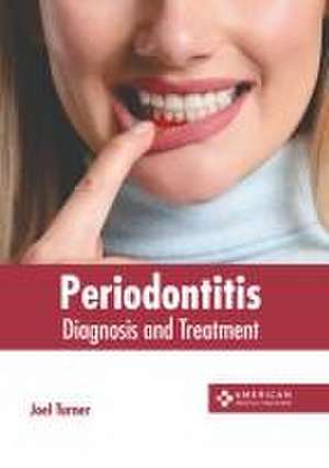 Periodontitis: Diagnosis and Treatment de Joel Turner