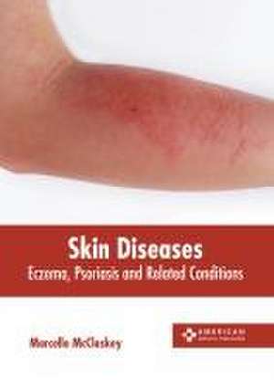 Skin Diseases: Eczema, Psoriasis and Related Conditions de Marcello McCloskey