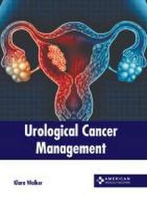 Urological Cancer Management de Klara Walker