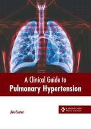 A Clinical Guide to Pulmonary Hypertension de Jim Foster