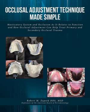 Occlusal Adjustment Technique Made Simple de Robert M. Zupnik DDS MSD