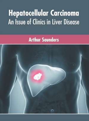 Hepatocellular Carcinoma: An Issue of Clinics in Liver Disease de Arthur Saunders