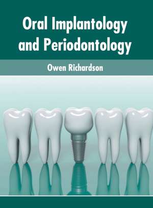 Oral Implantology and Periodontology de Owen Richardson