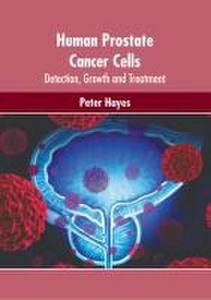 Human Prostate Cancer Cells: Detection, Growth and Treatment de Peter Hayes