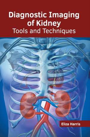 Diagnostic Imaging of Kidney: Tools and Techniques de Eliza Harris