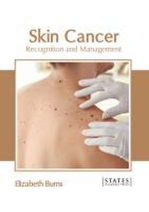 Skin Cancer: Recognition and Management de Elizabeth Burns