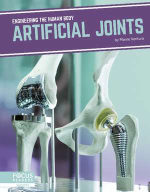 Artificial Joints de Marne Ventura