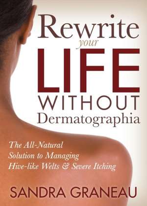 Rewrite Your Life Without Dermatographia: The All-Natural Solution to Managing Hive-Like Welts and Severe Itching de Sandra Graneau