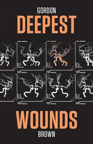 Deepest Wounds de Gordon Brown