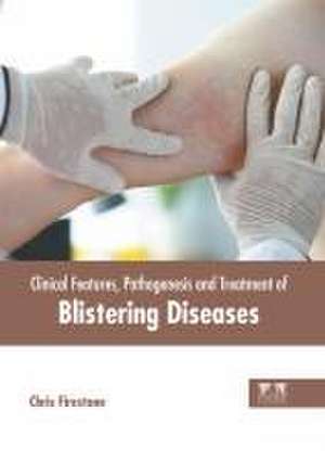 Clinical Features, Pathogenesis and Treatment of Blistering Diseases de Chris Firestone