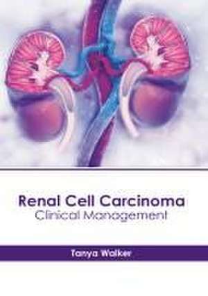 Renal Cell Carcinoma: Clinical Management de Tanya Walker