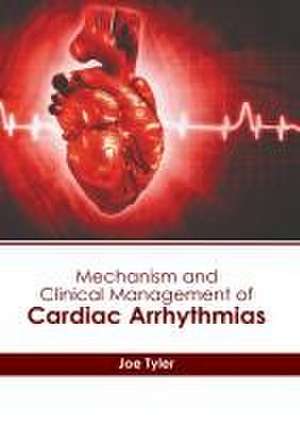 Mechanism and Clinical Management of Cardiac Arrhythmias de Joe Tyler