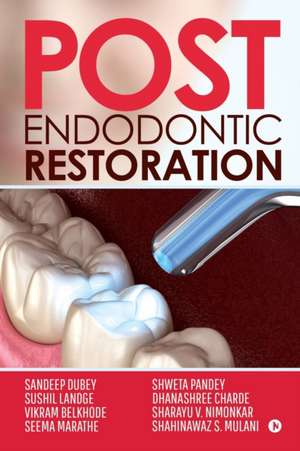 Post Endodontic Restoration de Sandeep Dubey