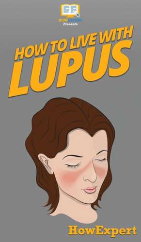 How To Live With Lupus de Howexpert