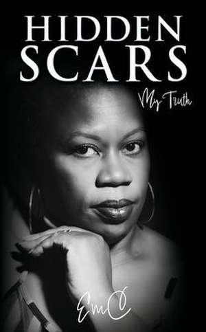 Hidden Scars: My Truth de Emc