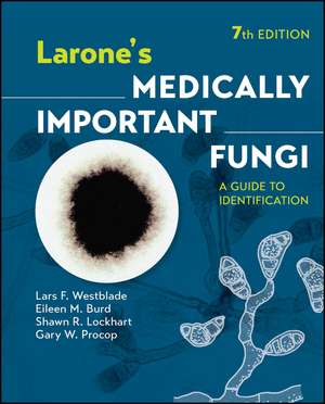 Larone′s Medically Important Fungi – A Guide to Identification, 7th Edition de Westblade