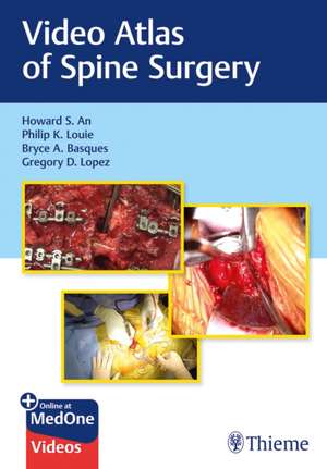 Video Atlas of Spine Surgery de Howard S. An