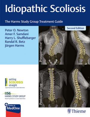 Idiopathic Scoliosis – The Harms Study Group Treatment Guide: The Harms Study Group Treatment Guide de Peter Newton