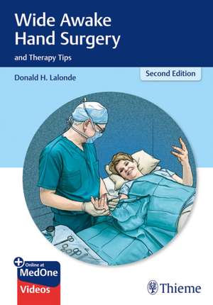 Wide Awake Hand Surgery and Therapy Tips de D Lalonde