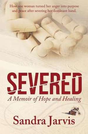 Severed de Sandra Jarvis