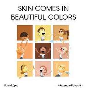 Skin comes in beautiful colors de Rocio M Lopez