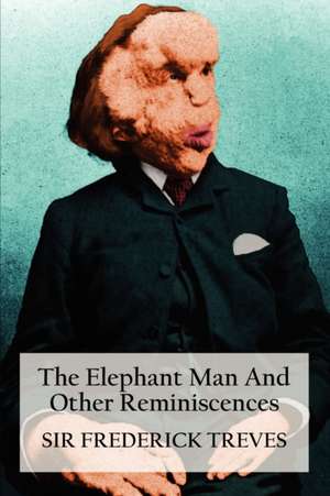 The Elephant Man and Other Reminiscences de Frederick Treves