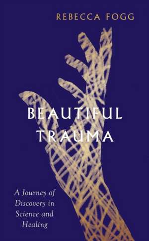 Beautiful Trauma de Rebecca Fogg