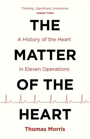 The Matter of the Heart: A History of the Heart in Eleven Operations de Thomas Morris