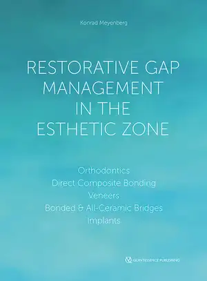 Restorative Gap Management in the Esthetic Zone de Konrad H. Meyenberg