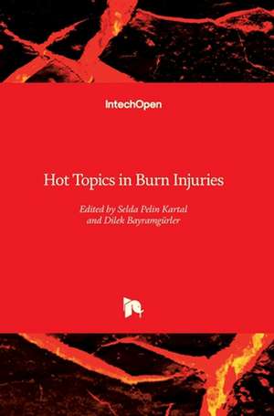 Hot Topics in Burn Injuries de Selda Pelin Kartal