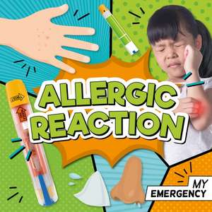 Allergic Reaction de Charis Mather