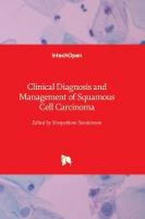 Clinical Diagnosis and Management of Squamous Cell Carcinoma de Sivapatham Sundaresan