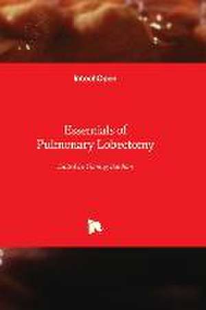 Essentials of Pulmonary Lobectomy de Bat&