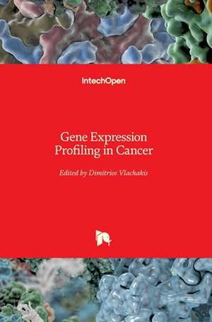 Gene Expression Profiling in Cancer de Dimitrios Vlachakis