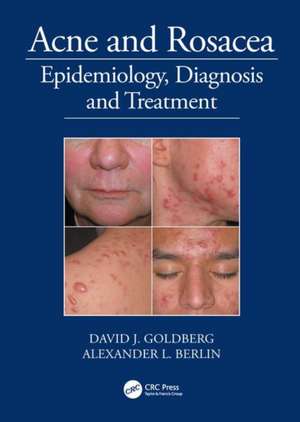 Acne and Rosacea: Epidemiology, Diagnosis and Treatment de David Goldberg