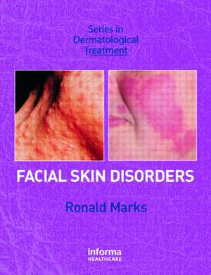 Facial Skin Disorders de Ronald Marks