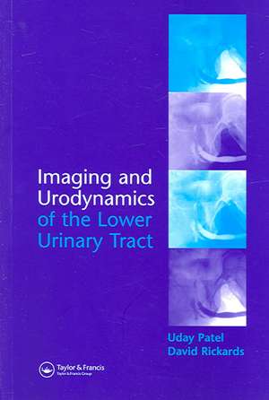 Imaging and Urodynamics of the Lower Urinary Tract de Uday Patel