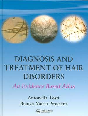 Diagnosis and Treatment of Hair Disorders: An Evidence-Based Atlas de Antonella Tosti