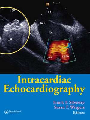 Intracardiac Echocardiography de Frank E. Silvestry