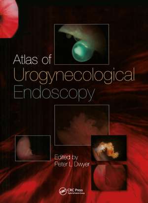 Atlas of Urogynecological Endoscopy de Peter L. Dwyer