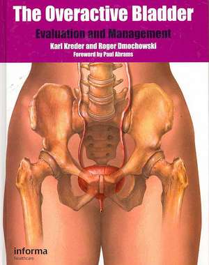 The Overactive Bladder: Evaluation and Management de Karl Kreder