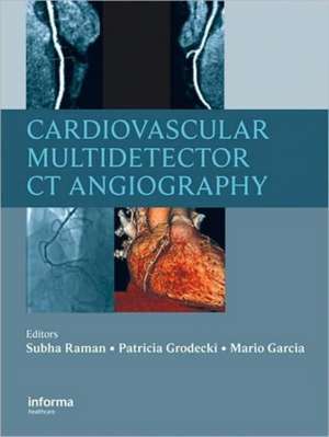 Cardiovascular Multidetector CT Angiography de Subha Raman