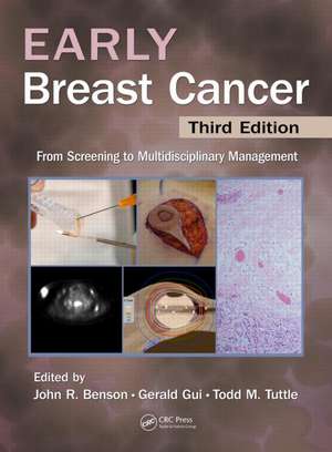 Early Breast Cancer: From Screening to Multidisciplinary Management, Third Edition de John R Benson