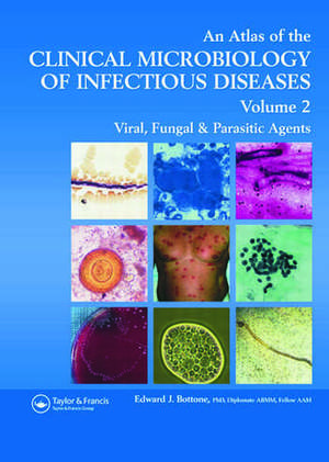 Atlas of the Clinical Microbiology of Infectious Diseases: Viral, Fungal and Parasitic Agents de Edward J. Bottone