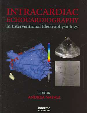 Intracardiac Echocardiography in Interventional Electrophysiology: Advanced Management of Atrial Fibrillation and Ventricular Tachycardia de Andrea Natale