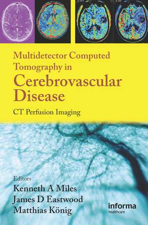 Multidetector Computed Tomography in Cerebrovascular Disease: CT Perfusion Imaging de Kenneth Miles