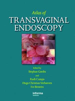 Atlas of Transvaginal Endoscopy de Stephan Gordts