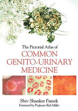 The Pictorial Atlas of Common Genito-Urinary Medicine de Shiva Pareek